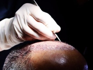 DEAŞ'lı teröristin 'saç ektirme' yalanı