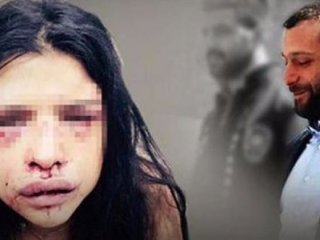 Bakanlık'tan Onur Özbizerdik itirazı!