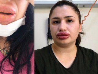 Bir slikon rezaleti daha! Tek mağdur o değilmiş!