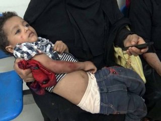 Yemen’de çatışma: 6 ölü, 20 yaralı