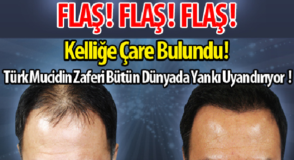 Başınıza gelebilecek en güzel şey bu olsa gerek