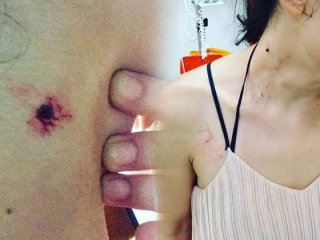 'Müzisyen kadına polis dayağı' haberine açıklama!