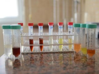 Elektronik sigaranın gizli tehlikesi