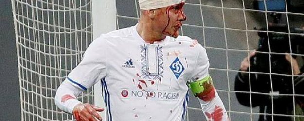 Domagoj Vida hastaneye kaldırıldı!