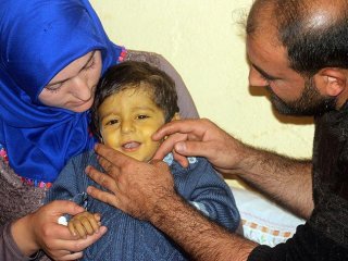 Minik Şerzan sağlığına kavuşmak için organ nakli bekliyor
