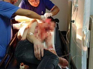 Travesti dehşeti! Ustura ile onu bu hale getirdi..