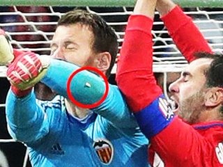 Görenler şok oldu! Kalecini kolunda kaldı...
