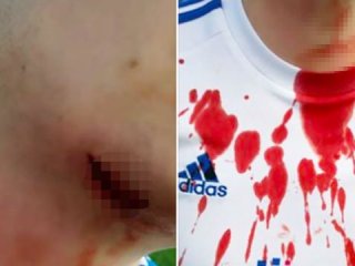 Futbol terörü! Boğazını bıçakla kesti!