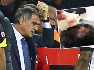 Kan var mıydı? Şenol Güneş'in doktoru açıkladı