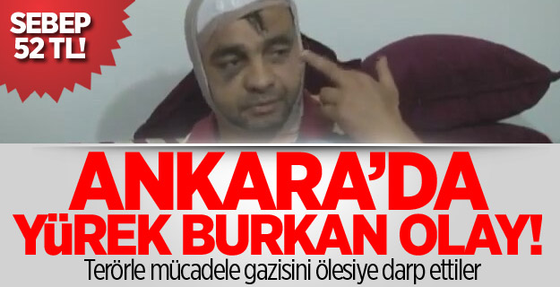 Başkent’te gazi ve kardeşine çirkin saldırı