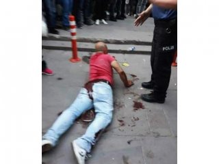 Ankara'da tacizciye baba bıçağı