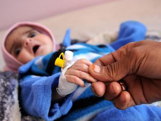 'Yemen'de 10 dakikada 1 çocuk ölüyor'