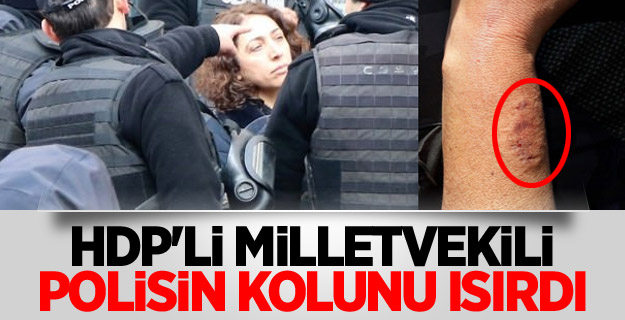 HDP'li milletvekili, polisin kolunu ısırdı