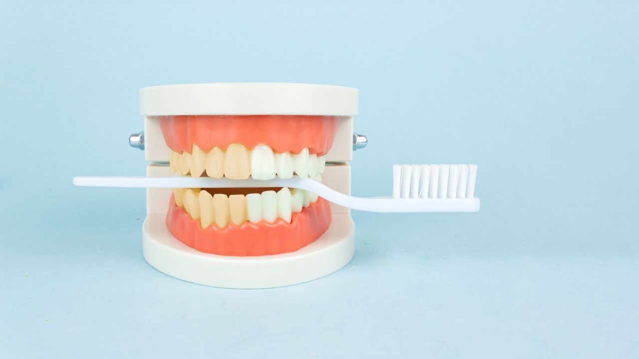Diş sararması neden olur? Diş sararmasına ne iyi gelir? Diş sararması nasıl geçer?