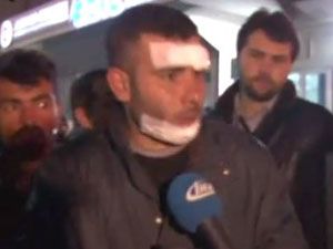 Görgü tanığı Ankara’daki dehşet anlarını anlattı